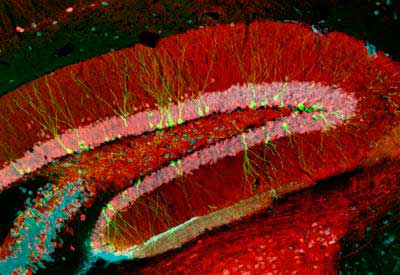 Foto: Argentina, Ciencia - Imagen obtenida por microscopía confocal, correspondiente a un corte de hipocampo obtenido de ratones adultos. En verde fluorescente pueden observarse neuronas granulares inmaduras (21 días de edad) generadas en el cerebro adulto. Para marcar y visualizar las neuronas nuevas, los investigadores emplean un retrovirus como herramienta para insertar en el genoma de las células en división (neuronas nuevas) el gen de la proteína verde fluorescente (GFP). / Fuente: Lic. M. Georgina Davies-Sala.